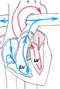 visualise blood flow through the normal heart